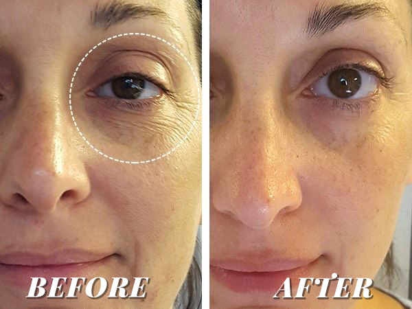 CORSILK Hyaluronic Acid Serum Vials