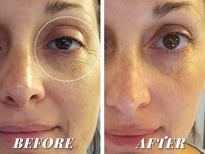 CORSILK Hyaluronic Acid Serum Vials
