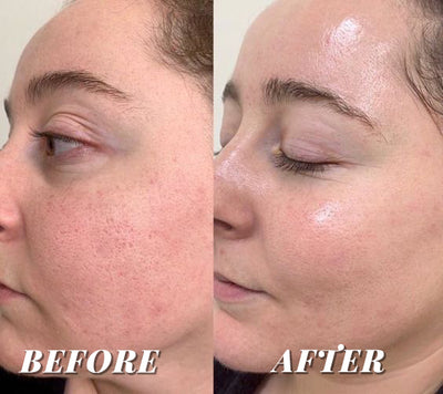 CORSILK PureSkin Mask