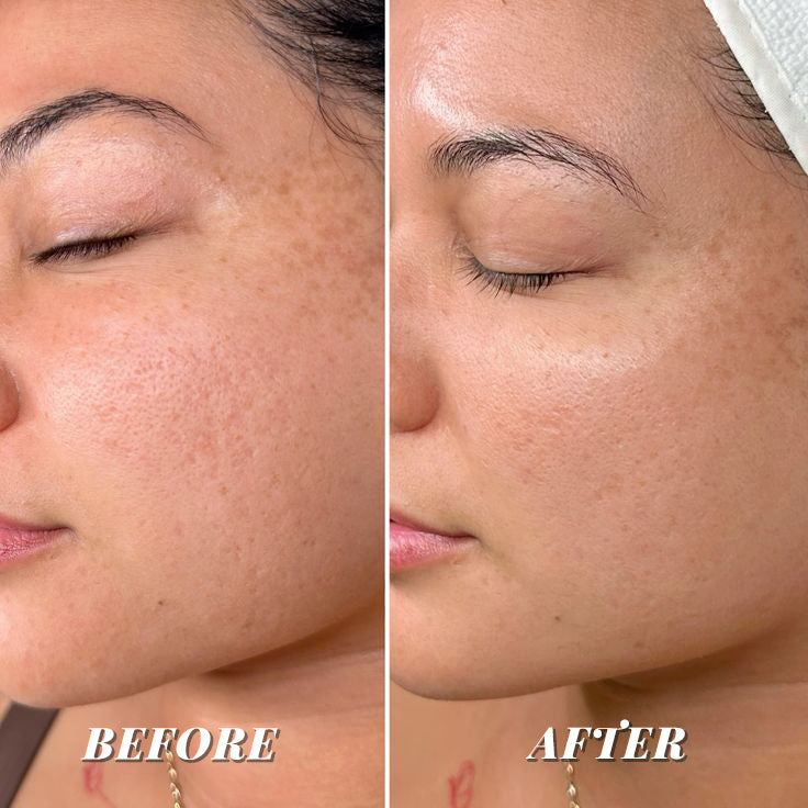 CORSILK PureSkin Mask