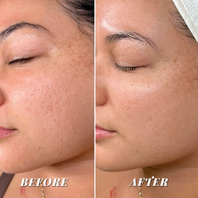 CORSILK PureSkin Mask