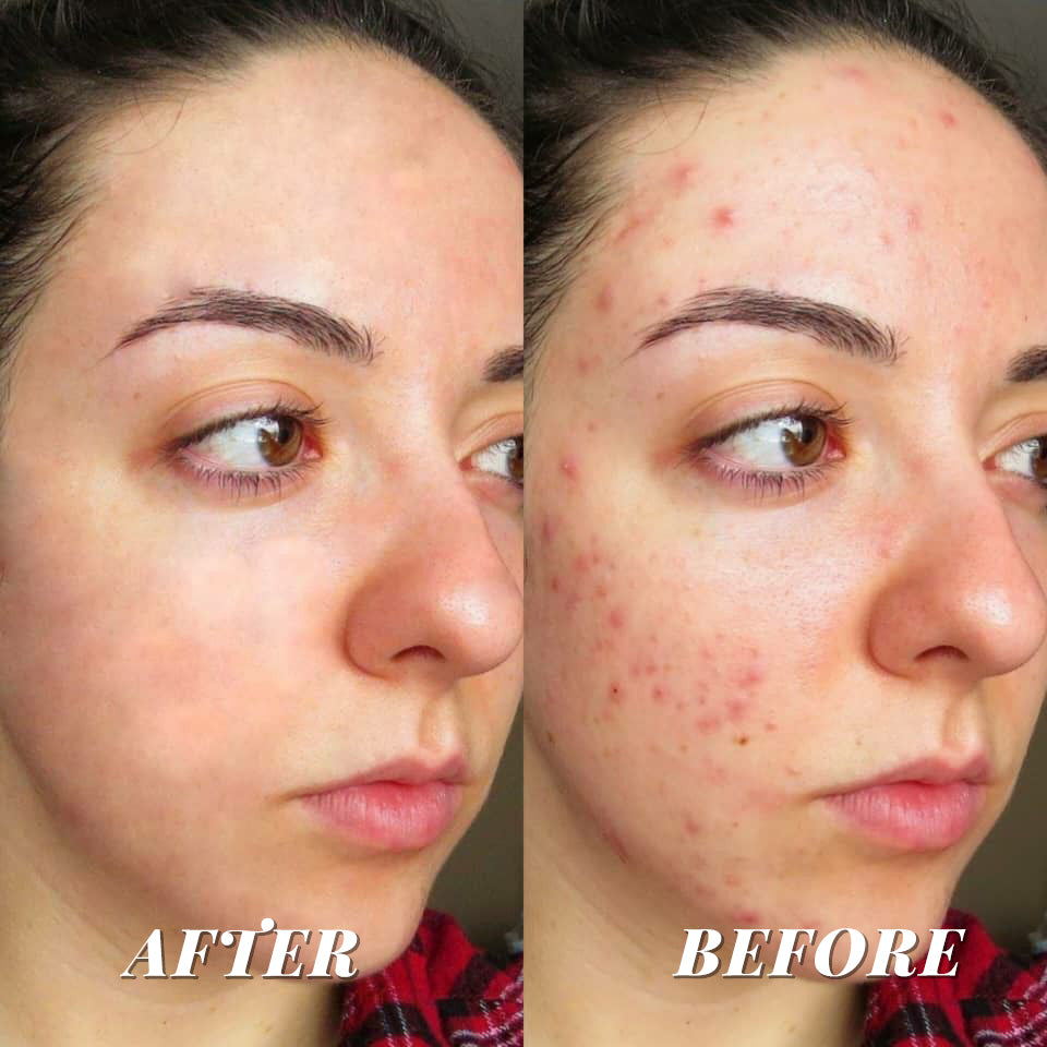 CORSILK Hyaluronic Acid Pore Shrinking Firming Foundation
