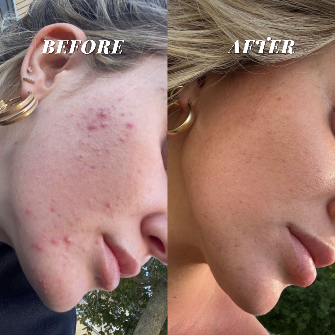 CORSILK Hyaluronic Acid Pore Shrinking Firming Foundation