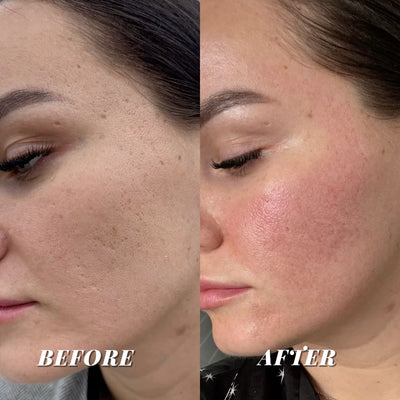 CORSILK PureSkin Mask
