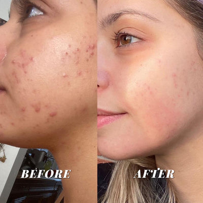 CORSILK Hyaluronic Acid Pore Shrinking Firming Foundation